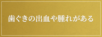 歯ぐきの出血や腫れがある